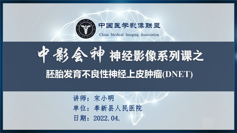 中影会神系列课之胚胎发育不良性神经上皮瘤