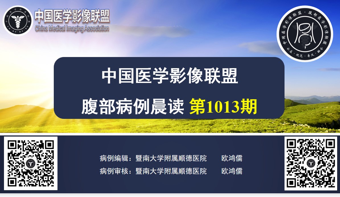 腹部病例晨读 第1013期