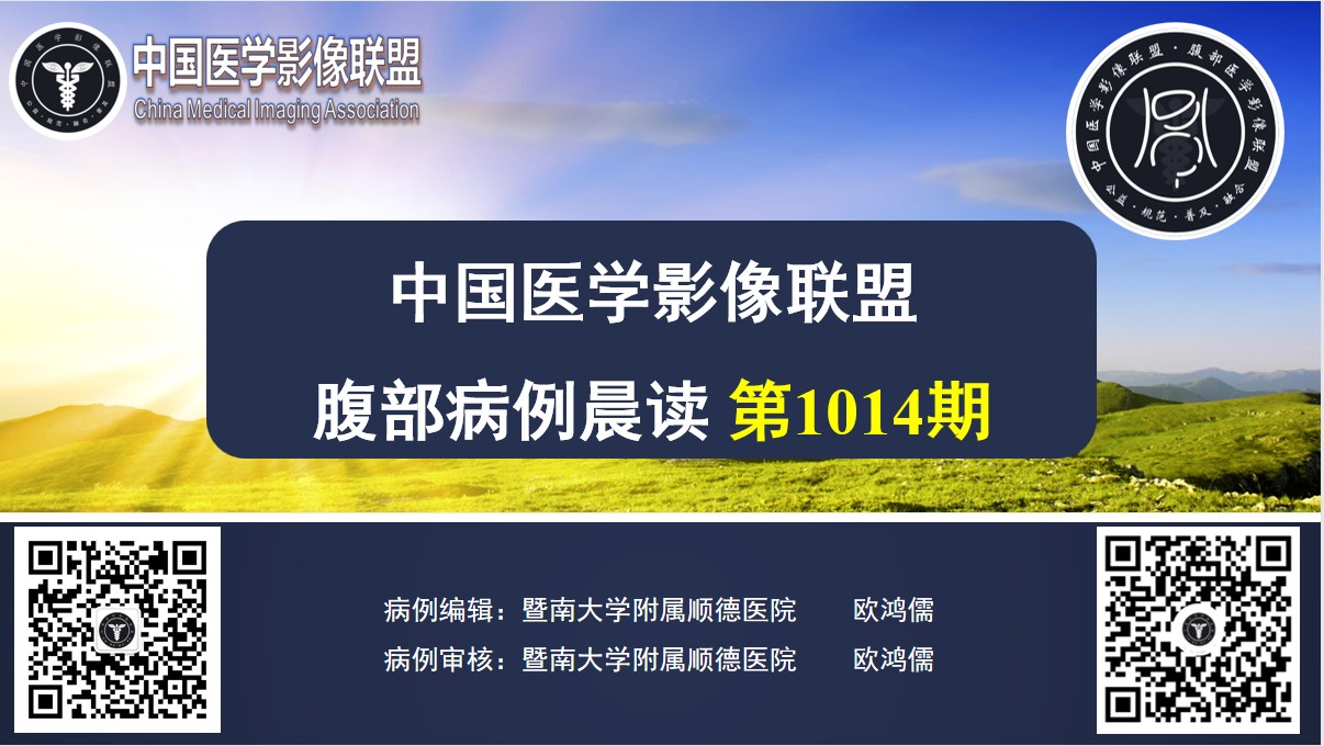 腹部病例晨读 第1014期