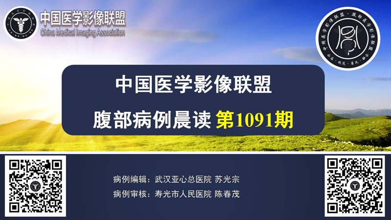 中影联盟腹部群晨读1091期病例