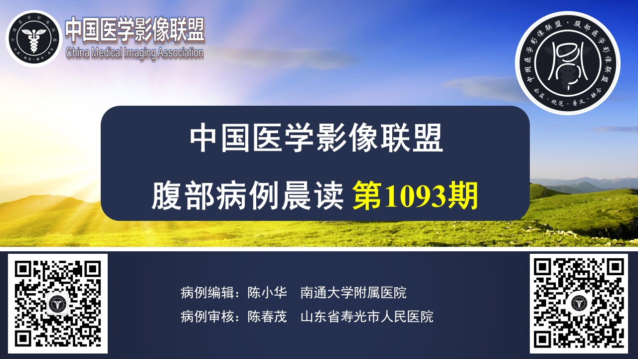 中影联盟腹部晨读病例第1093期结果