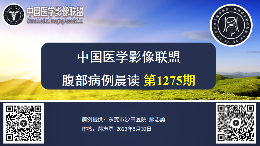 2023年8月30日中影联盟腹部晨读1275期