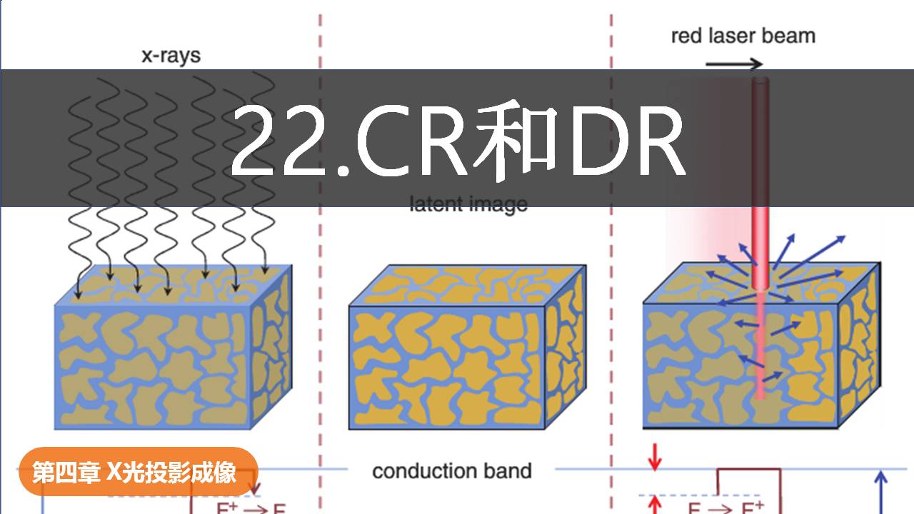 22. 计算机X射线CR和数字X射线DR