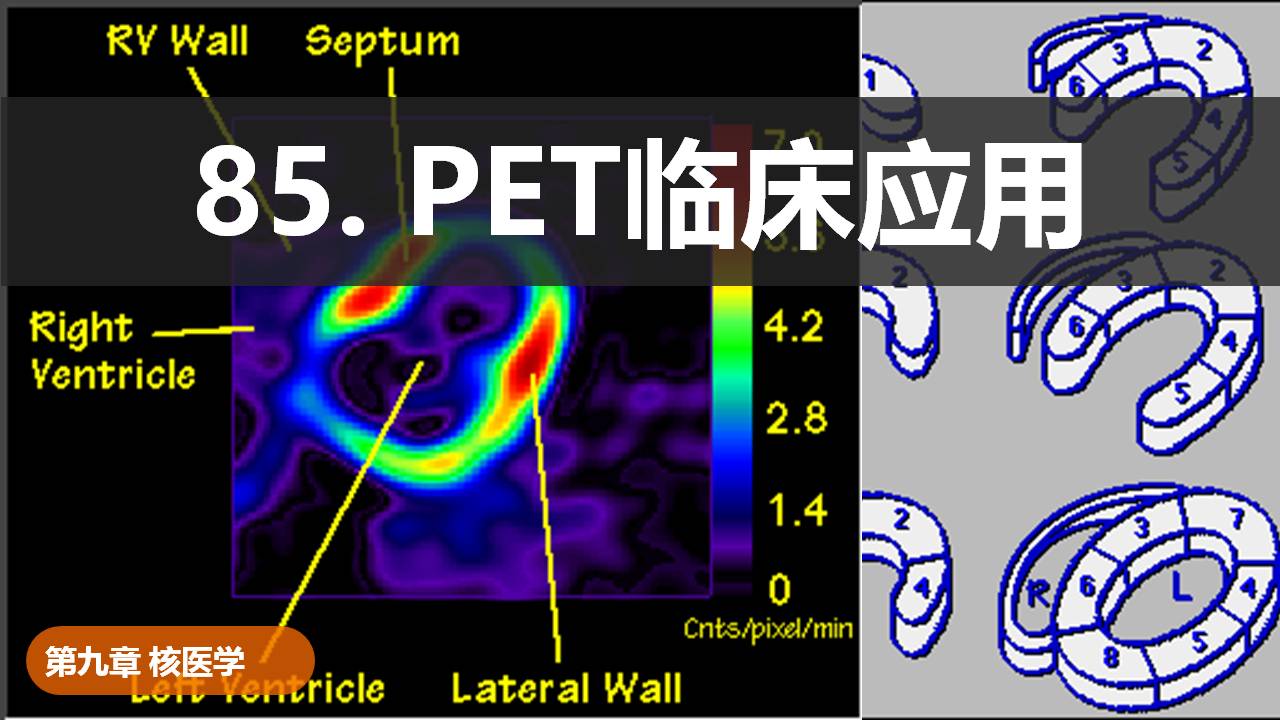 85.PET临床应用