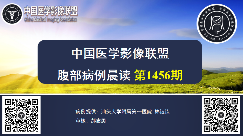 2024年4月22日 1456期 晨读