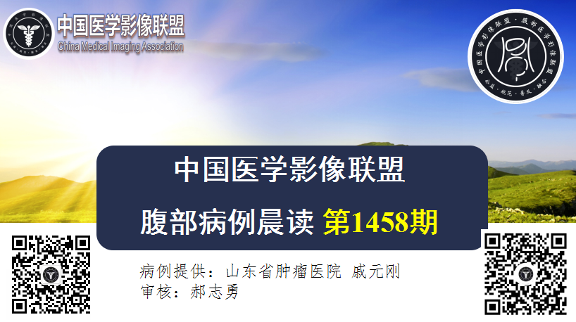 2024年4月24日 1458期 晨读