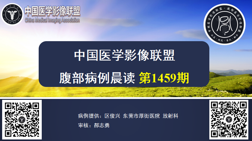 2024年4月25日 1459期 晨读