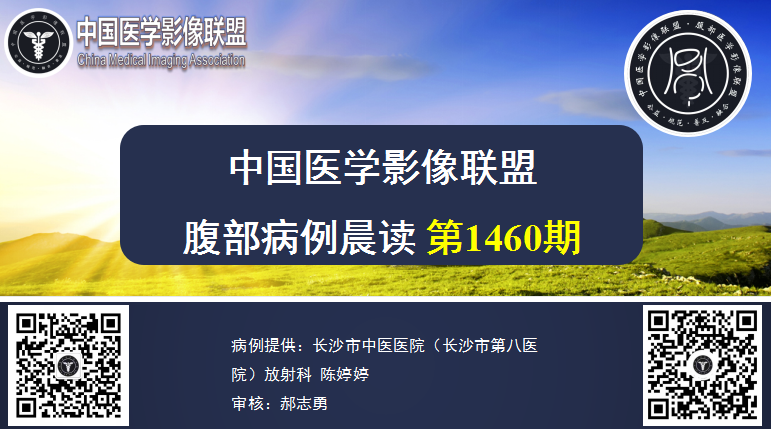 1460期4月26日 晨读