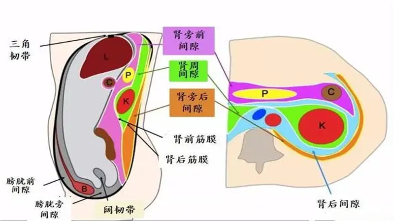 腹膜后节细胞神经瘤
