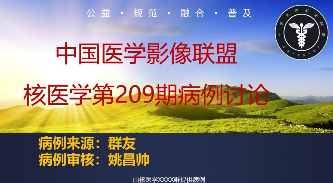 中影联盟核医学群病例讨论第209期--慢性淋巴细胞白血病/小淋巴细胞淋巴瘤