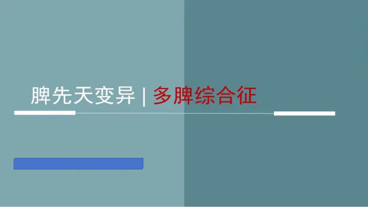 多脾综合征