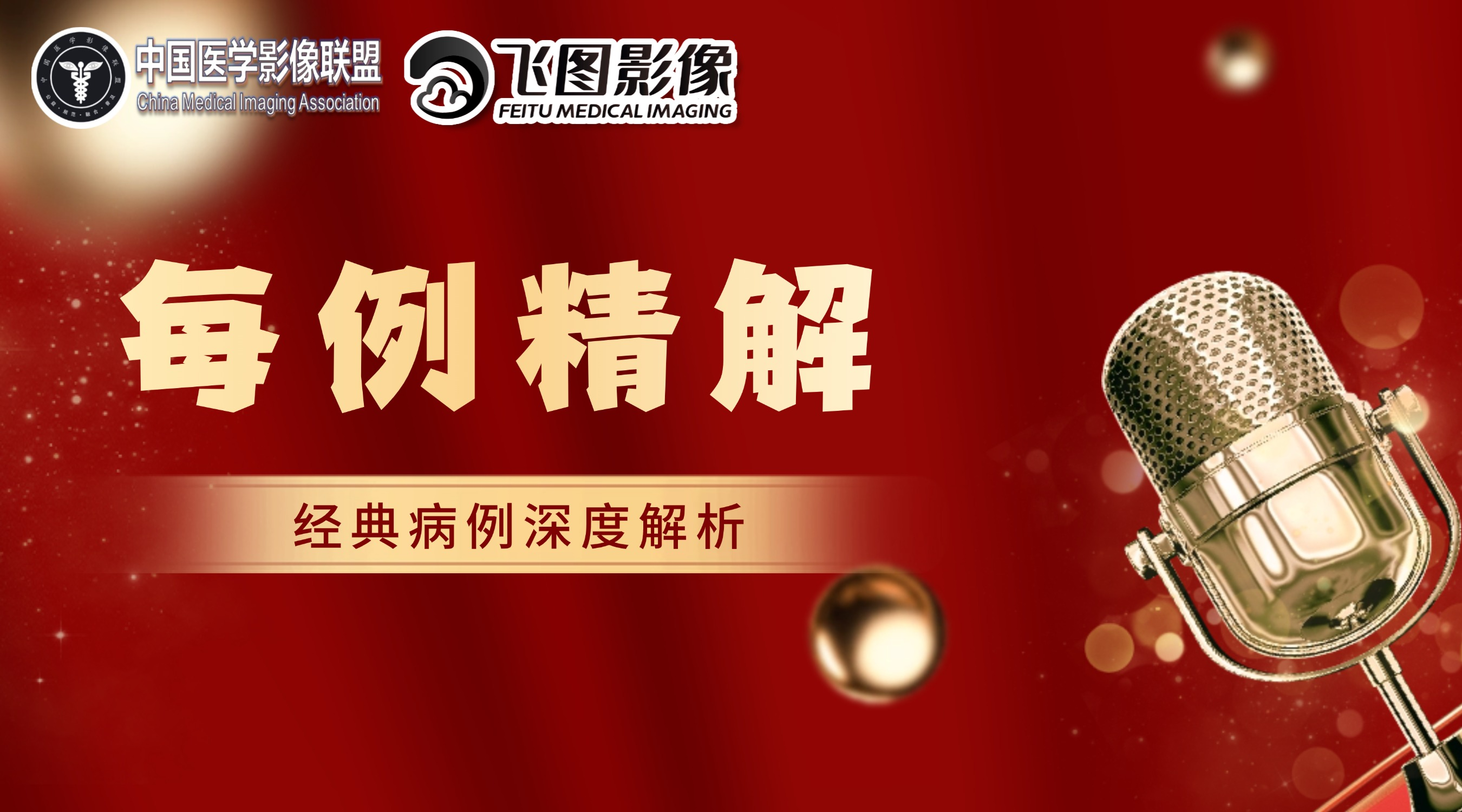 病毒性小脑炎