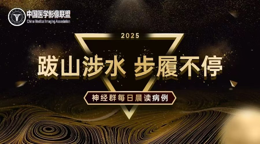 中影神经每日一例 第1460期