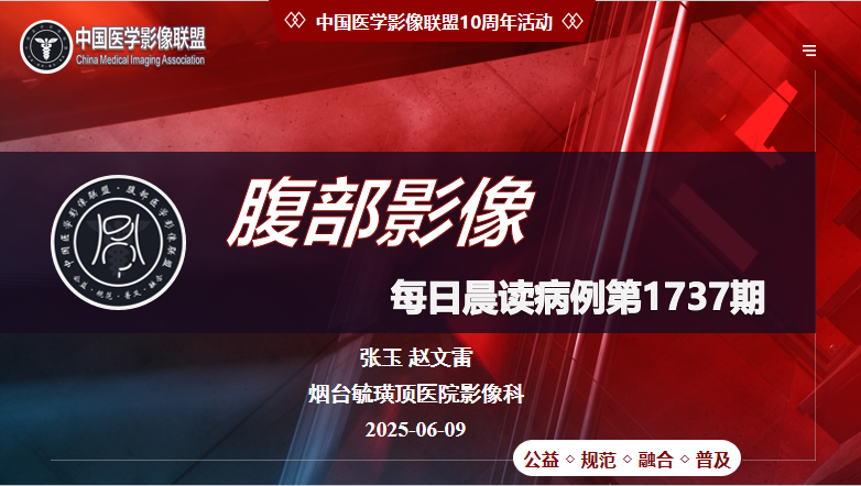 中影联盟腹部晨读第1737期