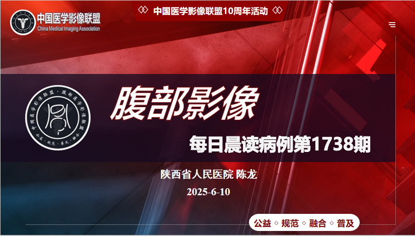 中影联盟腹部晨读第1738期晨读