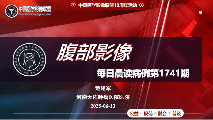 中影联盟腹部晨读第1741期