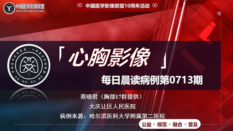 中影联盟-胸部病例晨读第0713期