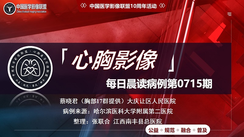中影联盟-胸部病例晨读第0715期