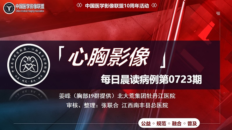 中影联盟-胸部病例晨读第0723期