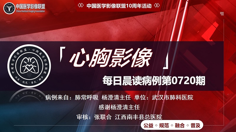 中影联盟-胸部病例晨读第0720期