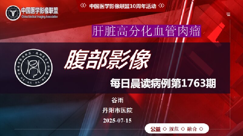 中影联盟腹部晨读1763期