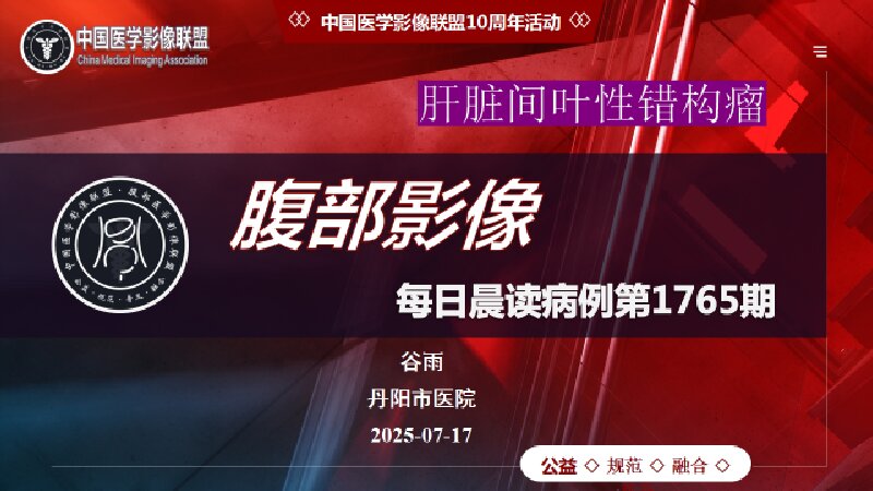 中影联盟腹部晨读1765期