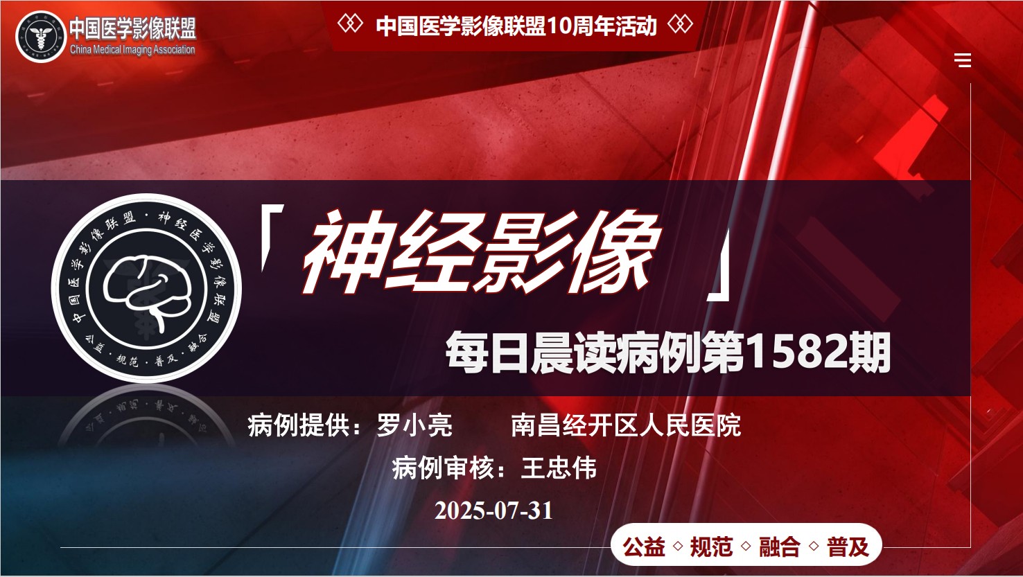 中影神经每日一例 第1582期