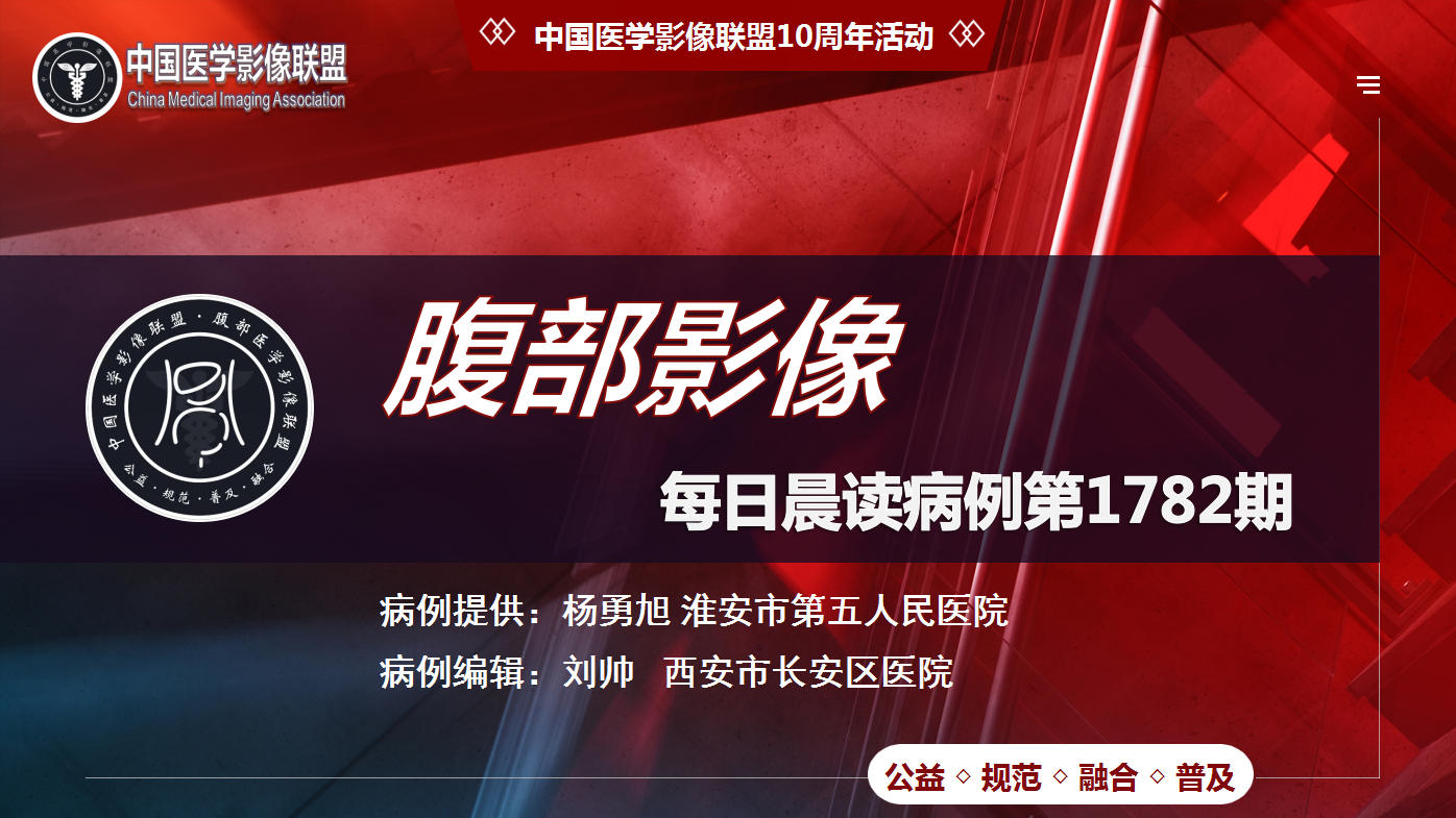 中影联盟腹部第1782期病例