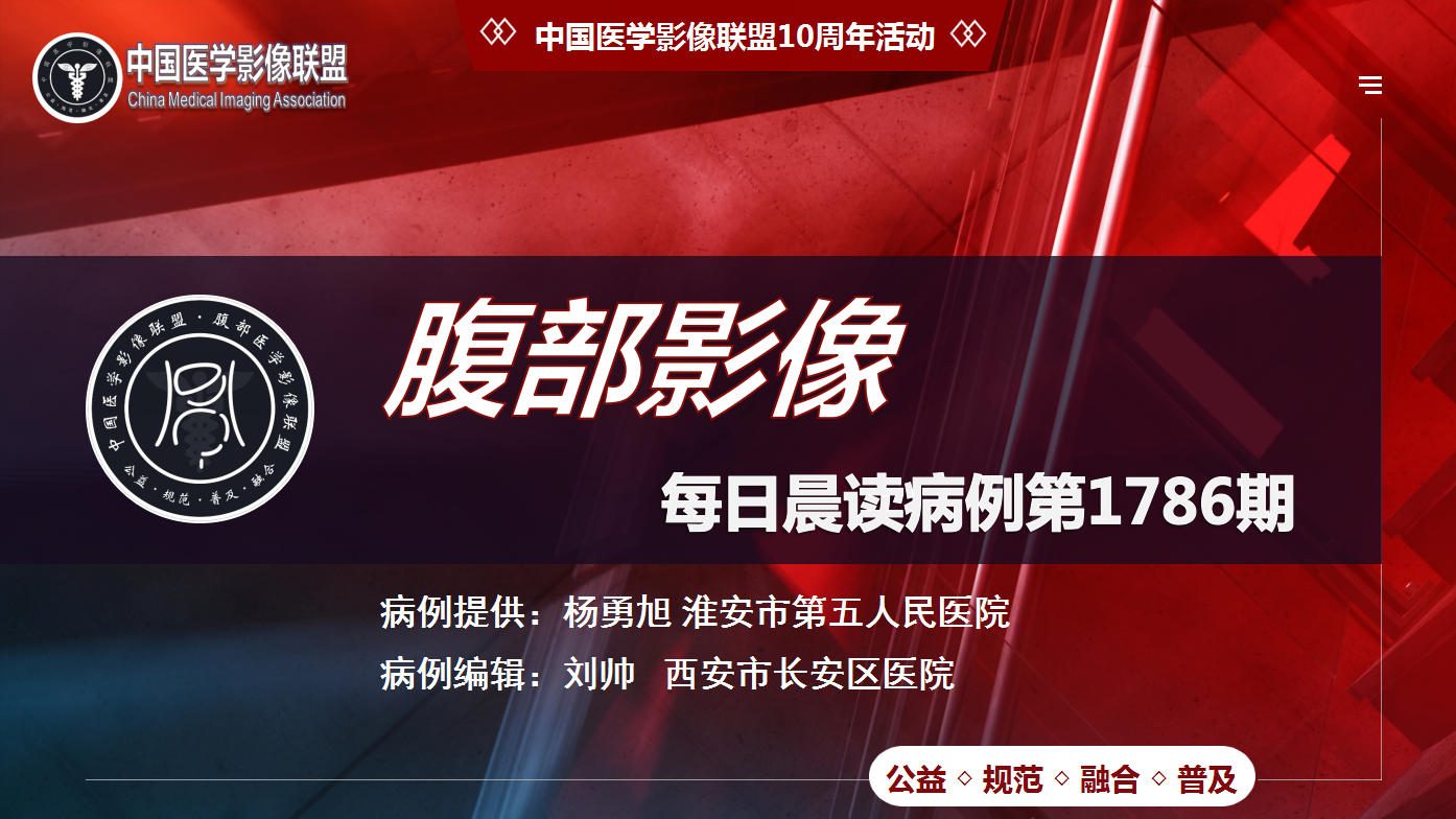 中影联盟腹部第1786期病例