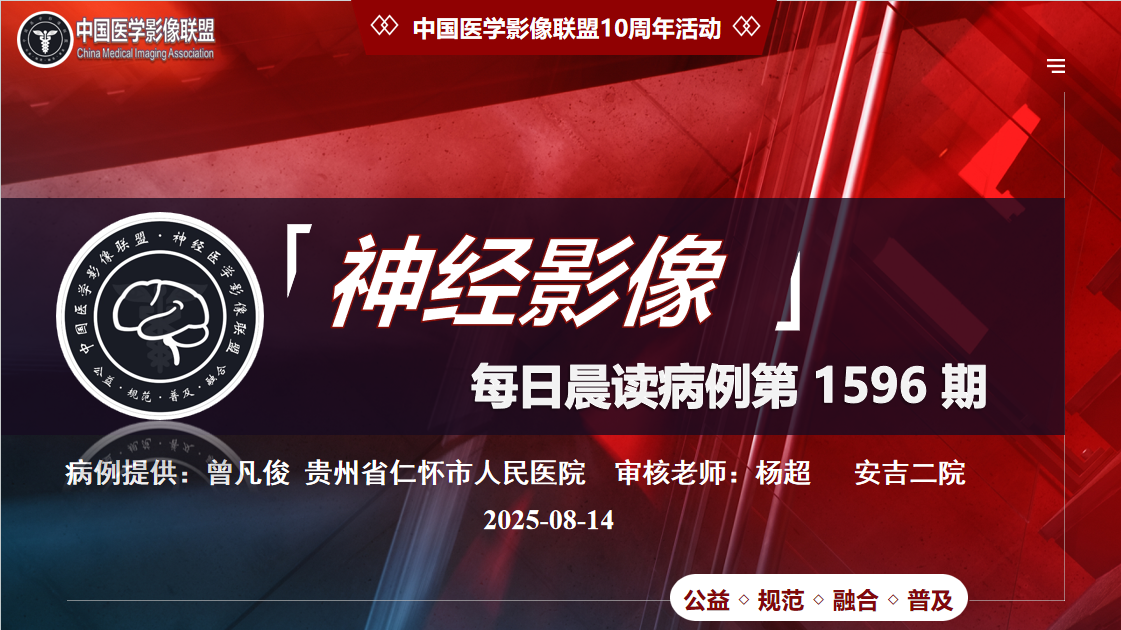 中影神经每日一例第1596期