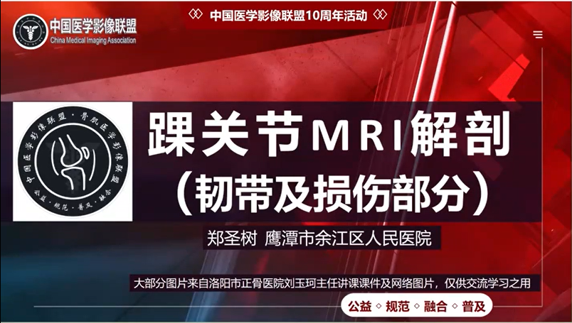 踝关节MRI解剖（韧带及损伤部分）