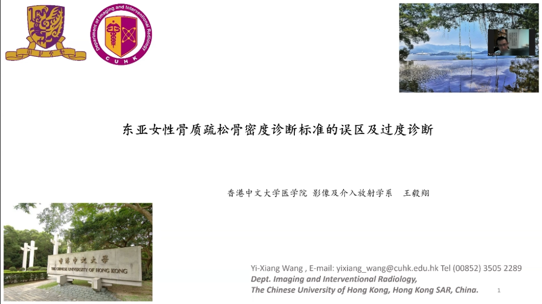 东亚女性骨质疏松骨密度诊断标准的误区及过度诊断