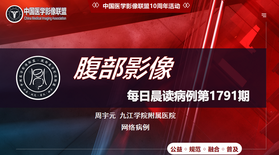 中影联盟腹部第1791期