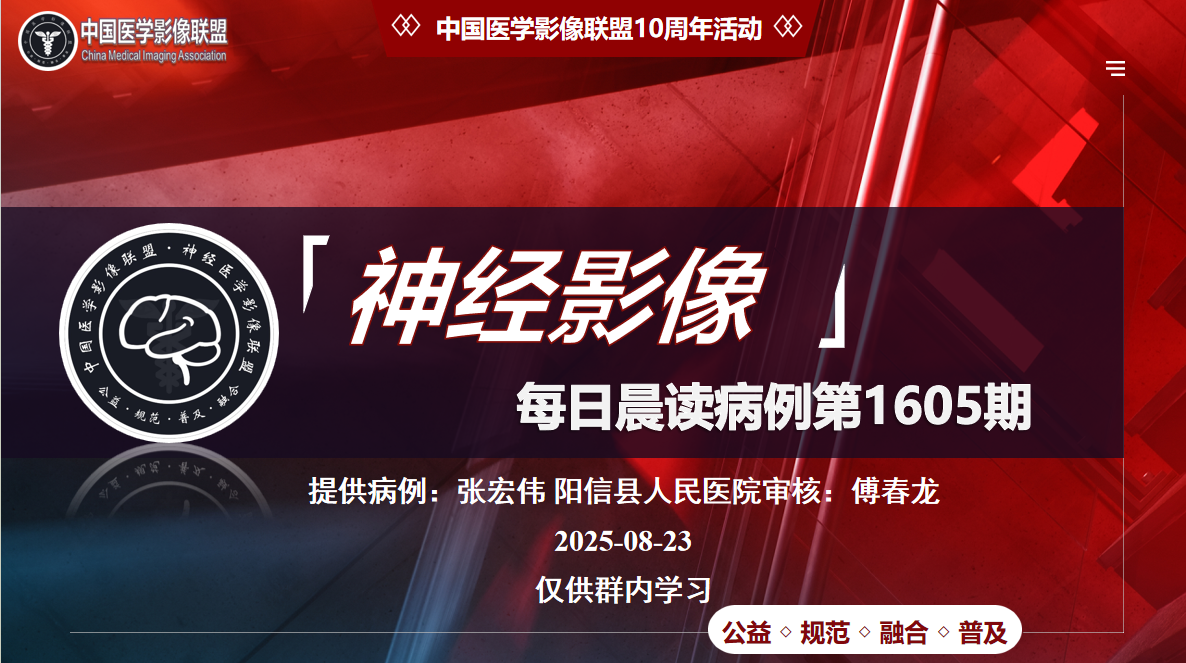 中影神经每日一例第1605期