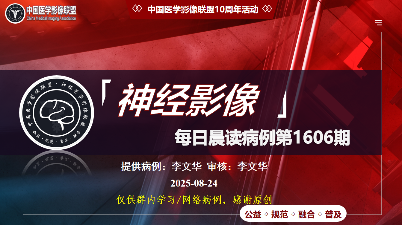 中影神经每日一例第1606期