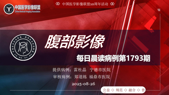 中国医学影像联盟2025-08-26腹部读片第1793期
