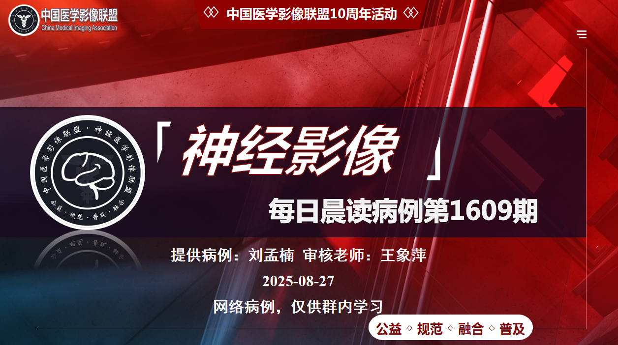 中影神经每日一例第1609期