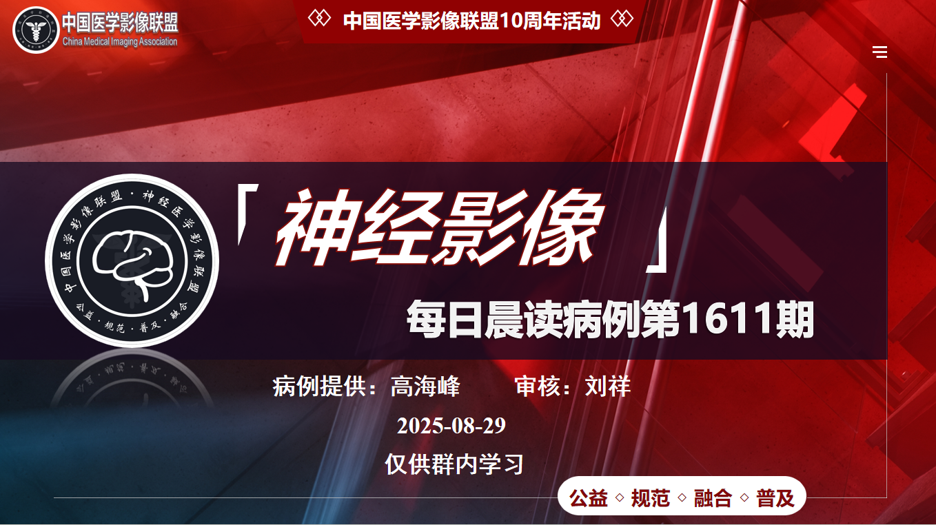 中影神经每日一例第1611期