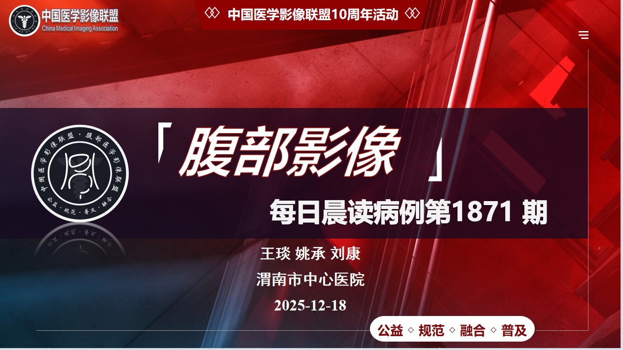 中影联盟腹部晨读第1871期