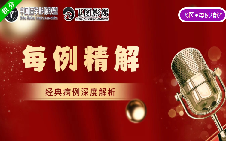 你会漏诊吗？——急性滑脱性髌股撞击综合征