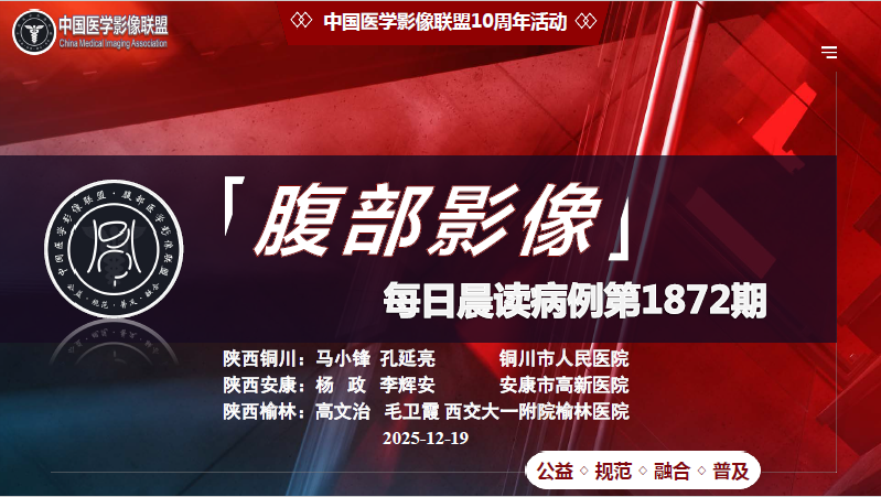 中影联盟腹部晨读第1872期