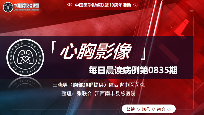 中影联盟-胸部病例晨读第0835期
