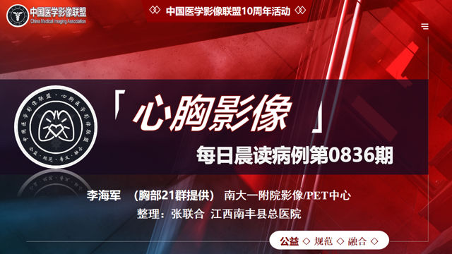 中影联盟-胸部病例晨读第0836期