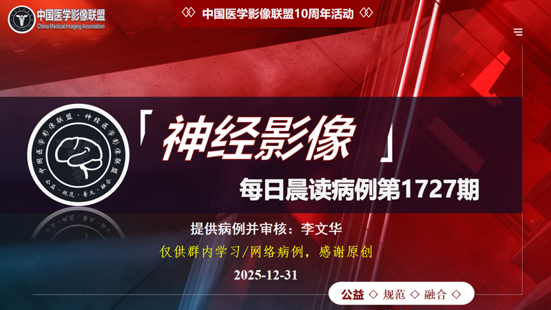 中影神经每日一例第1727期