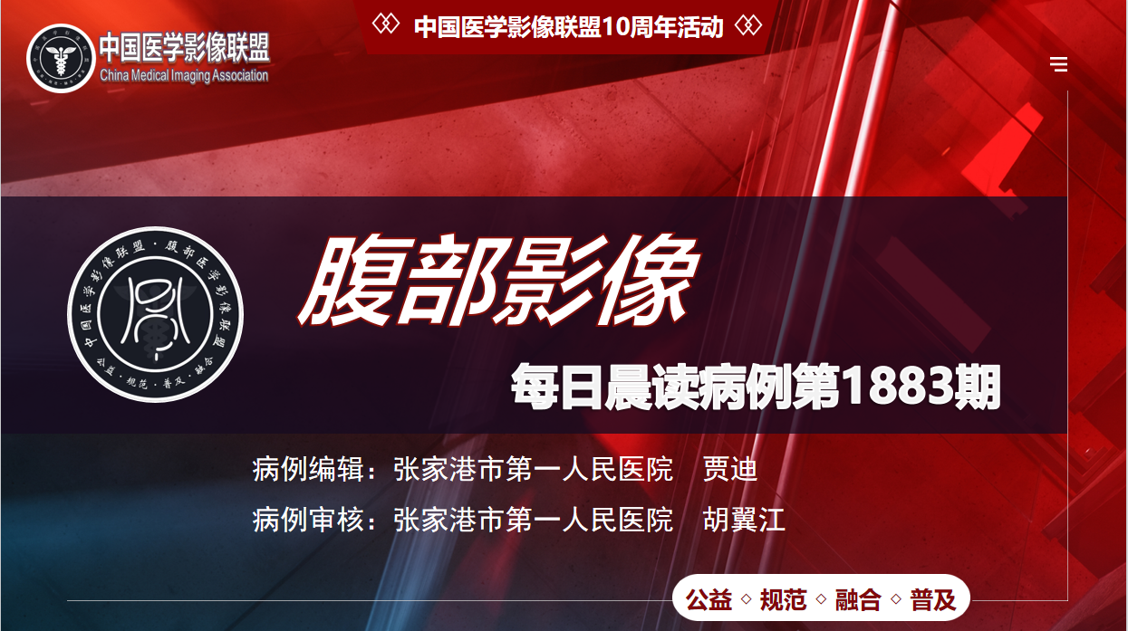 中影联盟腹部晨读1883期