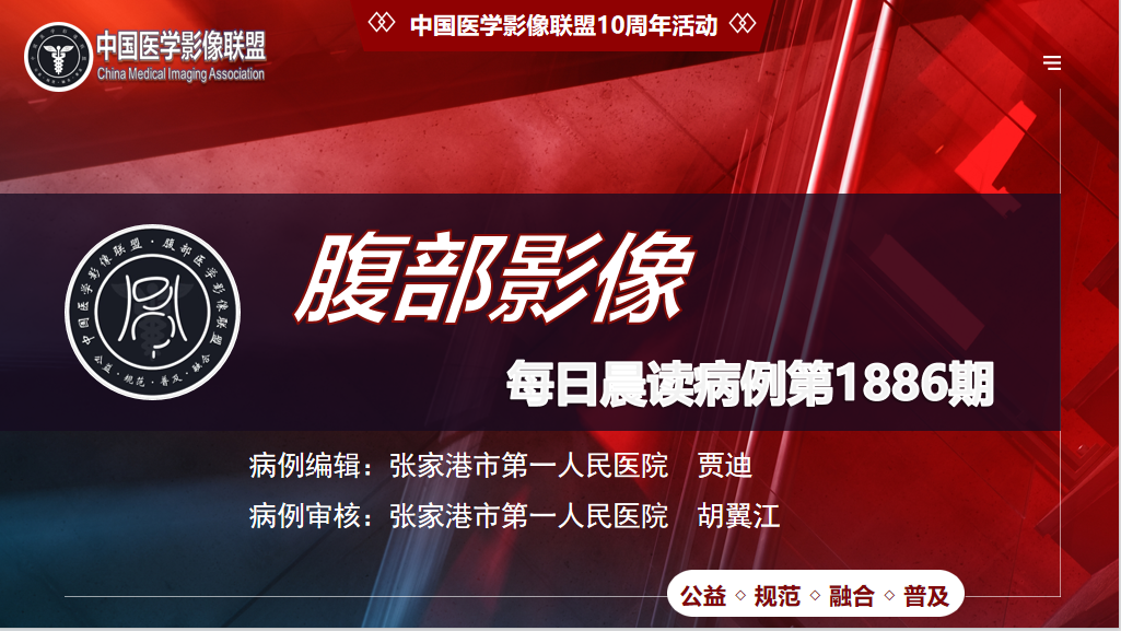 中影联盟腹部晨读1886期