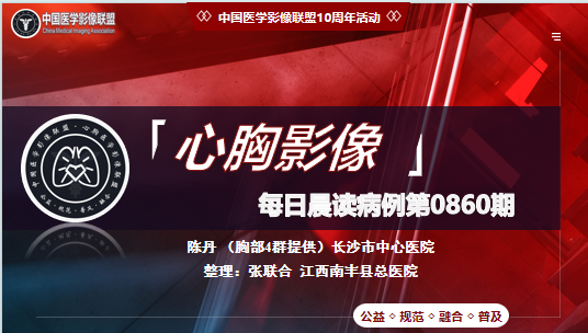 中影联盟-胸部病例晨读第0860期