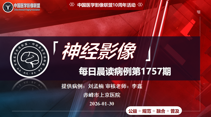 中影神经每日一例 第1757期 