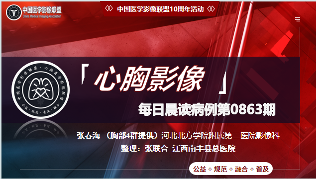 中影联盟-胸部病例晨读第0863期