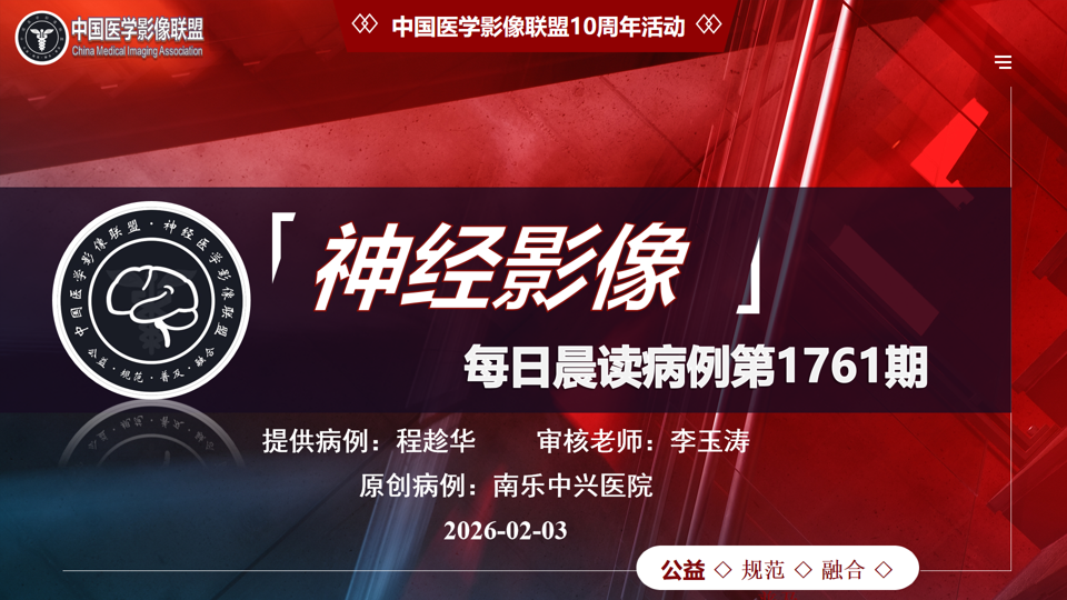 中影神经每日一例第1761期
